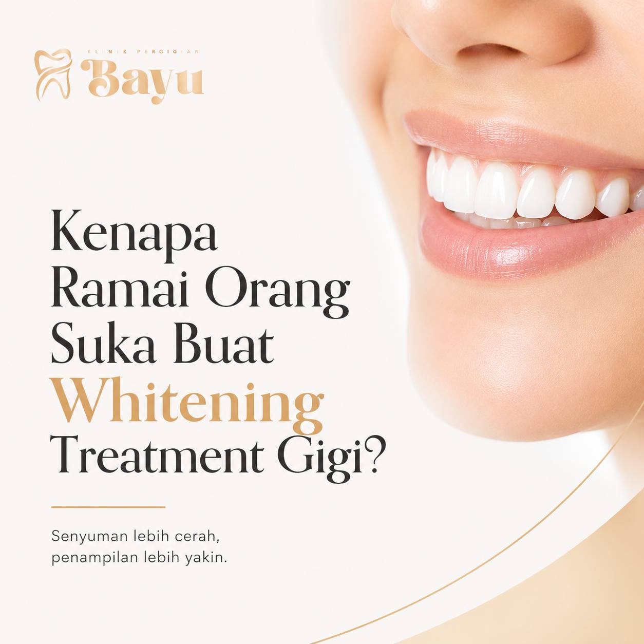 Kenapa Ramai Orang Suka Buat Whitening Treatment Gigi?