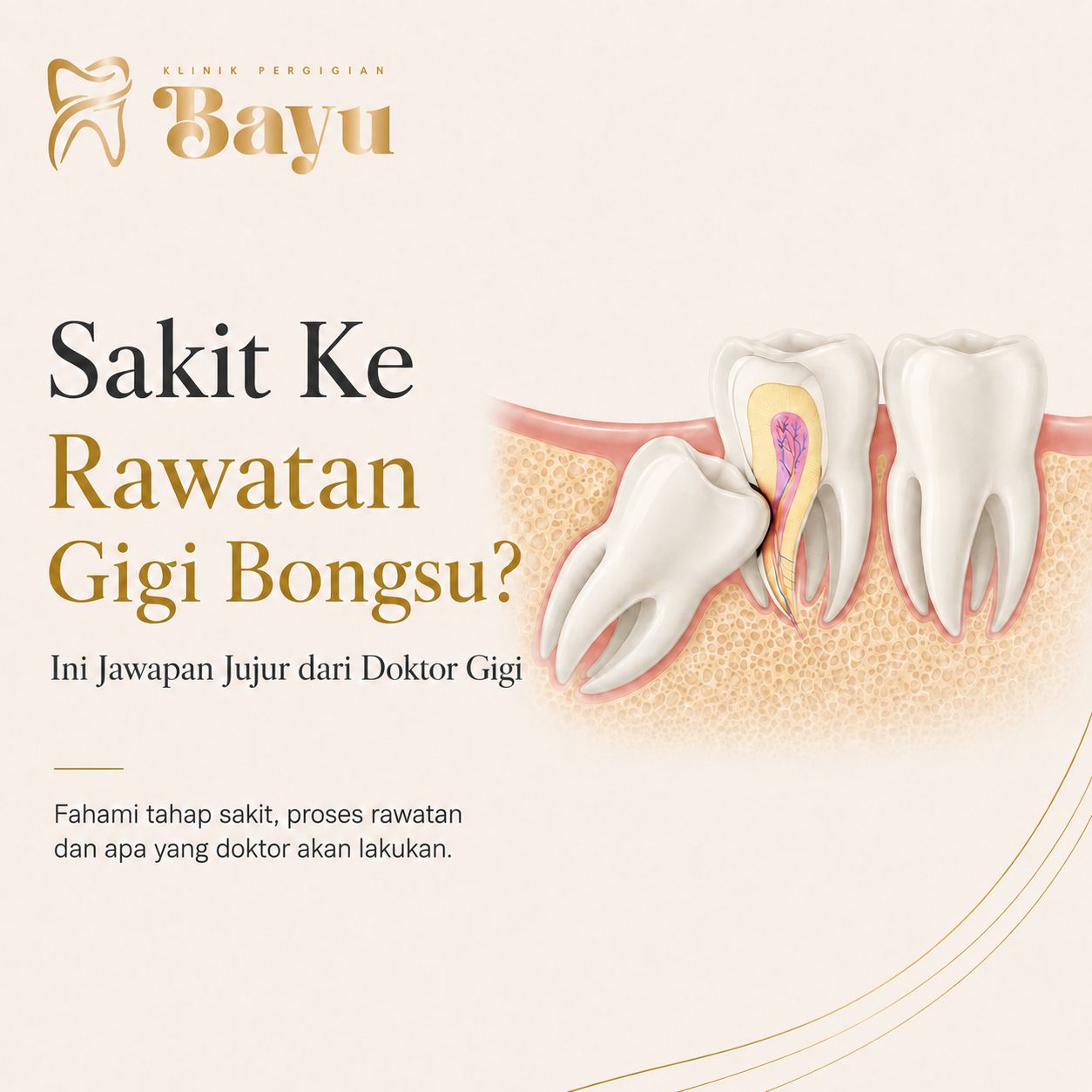 Sakit Ke Rawatan Gigi Bongsu? Ini Jawapan Jujur dari Doktor Gigi