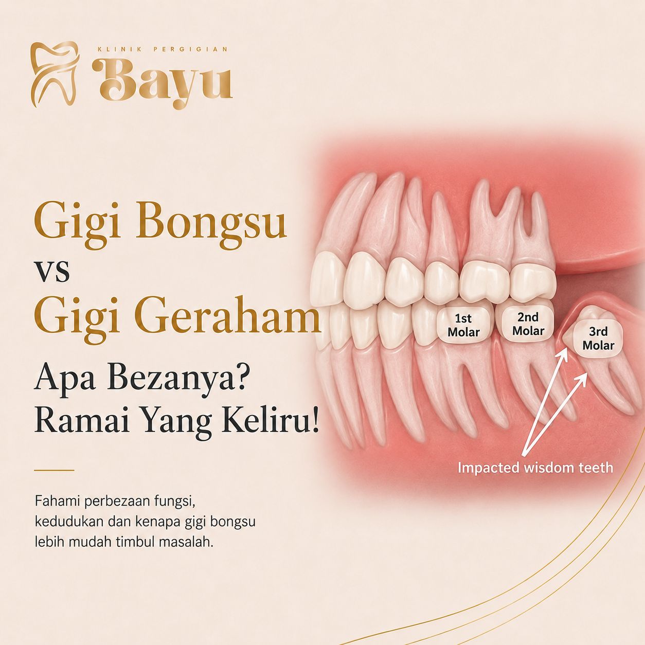 Gigi Bongsu vs Gigi Geraham. Apa Bezanya? Ramai Yang Keliru!